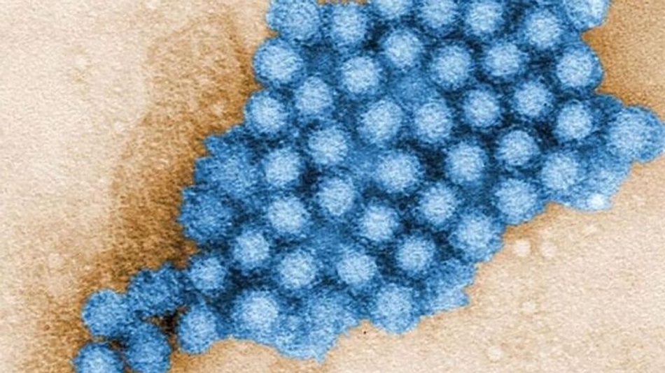 Imagen de un norovirus | EUROPA PRESS