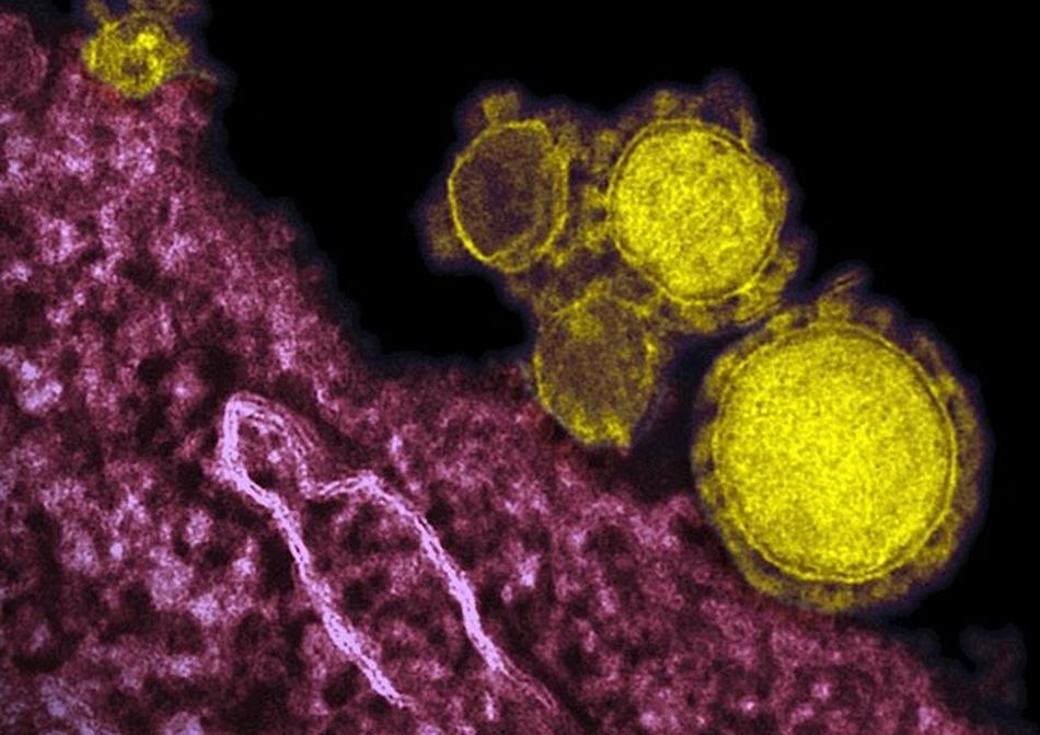 Sanidad eleva a 2.002 los casos de afectados por coronavirus, unas 363 más que el martes  