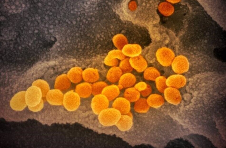 Esta imagen de microscopio electrónico de barrido muestra el SARS-CoV-2 (naranja). Foto: EP