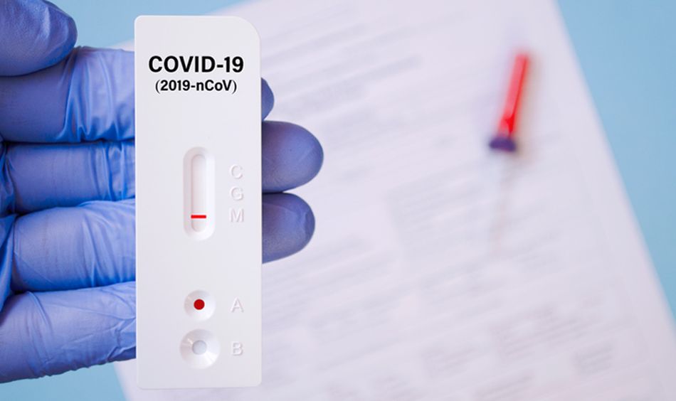 Test de autodiagnóstico de anticuerpos de Covid-19. Foto: Consejo General Colegios Oficiales de Farmacia
