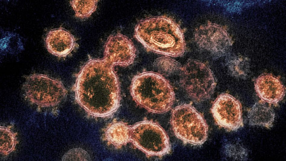 El virus SARS COV-2 visto a través de un potente microscopio - RML NIAID, Hamilton