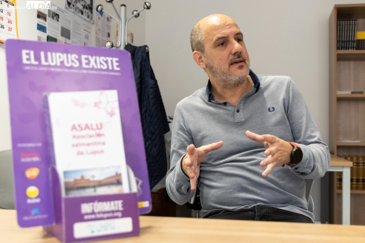 Lupus, una enfermedad que aparece cuando el cuerpo se rebela contra sí mismo | Imagen 1