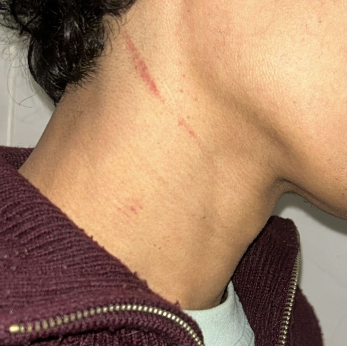 V&Iacute;DEO | El CD Villares niega agresiones de sus jugadores ante el Monterrey y denuncia que uno de sus futbolistas recibi&oacute; un pu&ntilde;etazo en el ojo | Imagen 1