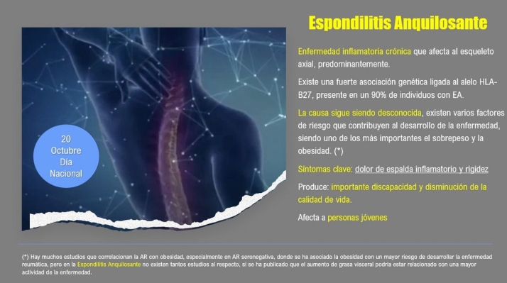 Desmontando la Espondilitis: &ldquo;No es el colch&oacute;n, no es el sof&aacute;, es tu espalda&rdquo; | Imagen 2